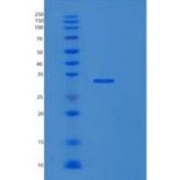 人RPS3A重组蛋白