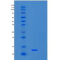 小鼠S100钙结合蛋白A6(S100A6)重组蛋白