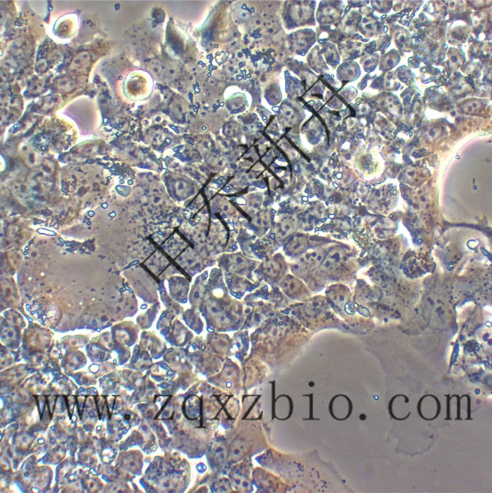 NCI-H2170人肺鳞癌细胞