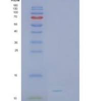 人SH3BGRL3重组蛋白