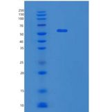 人丝氨酸羟甲基转移酶1(SHMT1)重组蛋白