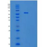 人丝氨酸羟甲基转移酶1(SHMT1)重组蛋白