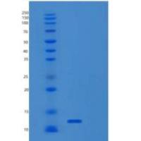 人S100钙结合蛋白P(S100P)重组蛋白