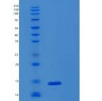 人S100钙结合蛋白A9(S100A9)重组蛋白