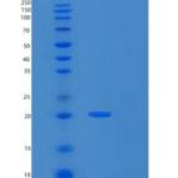 人RPS10重组蛋白