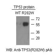 TP53(R282W) Polyclonal Antibody
