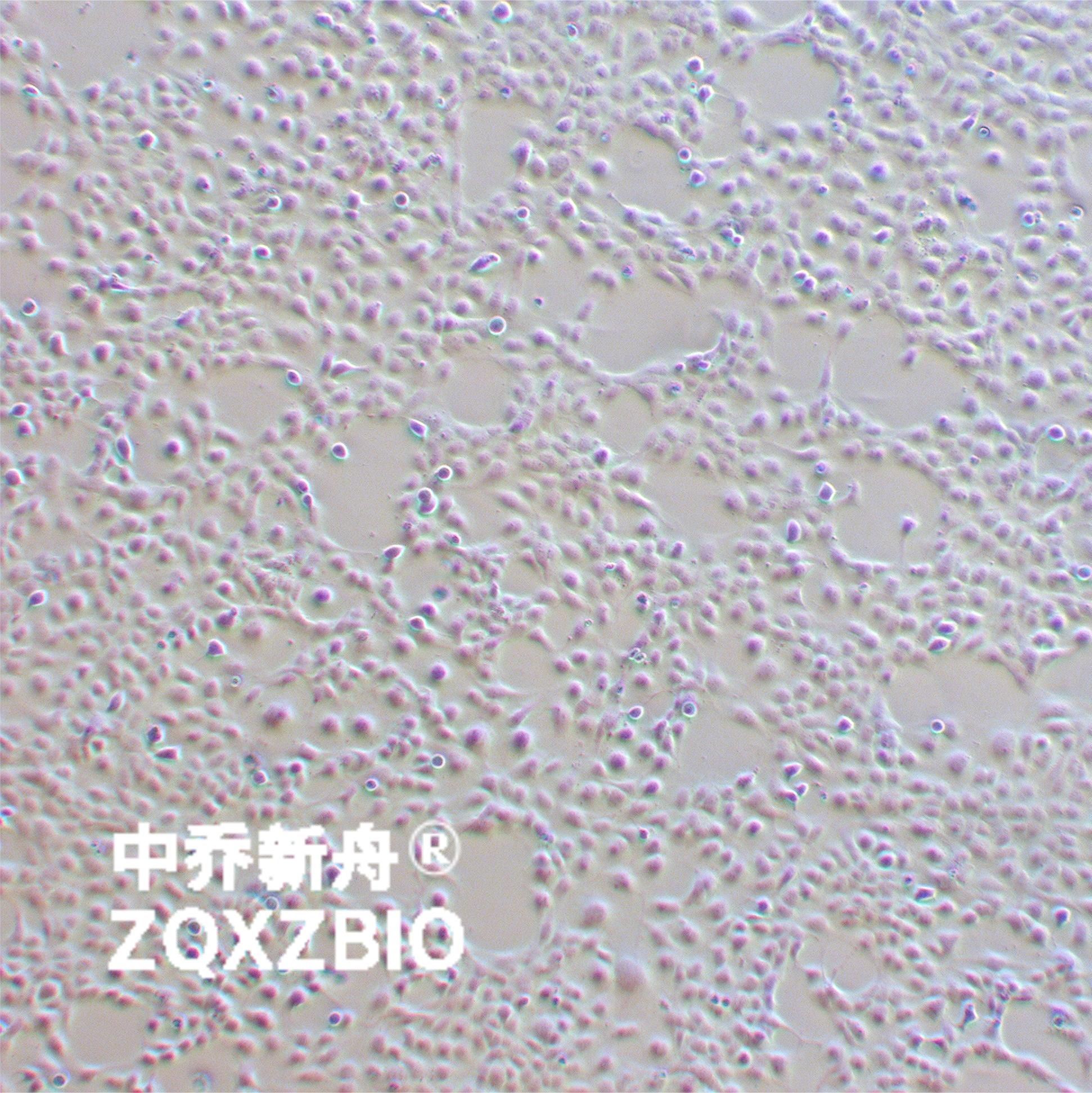LX-2人肝星形细胞
