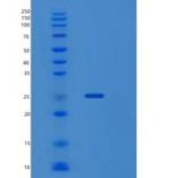 人多配体蛋白聚糖1(SDC1)重组蛋白