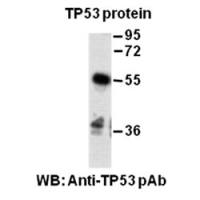 TP53 Polyclonal Antibody
