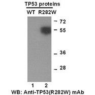 TP53(R282W)