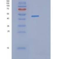 人SERPINB2重组蛋白