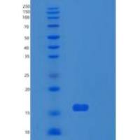 人核糖体蛋白S24(RPS24)重组蛋白