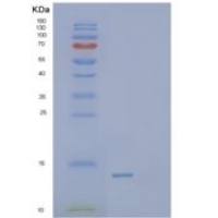 人S100钙结合蛋白A14(S100A14)重组蛋白