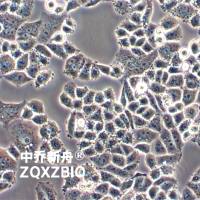 C-33 A人子宫颈癌