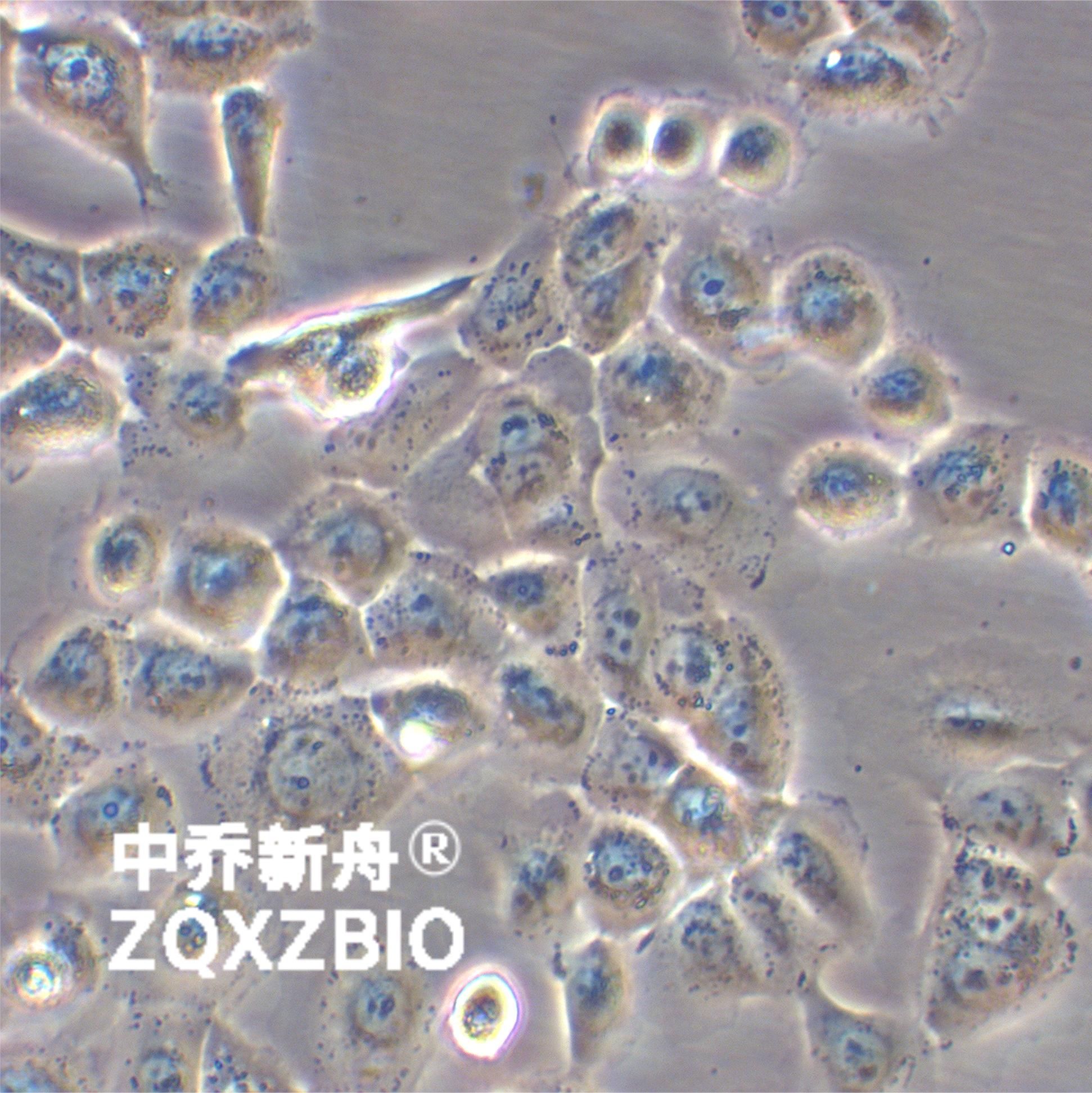 HCC 94 [HCC941122]人子宫鳞癌细胞（高分化）