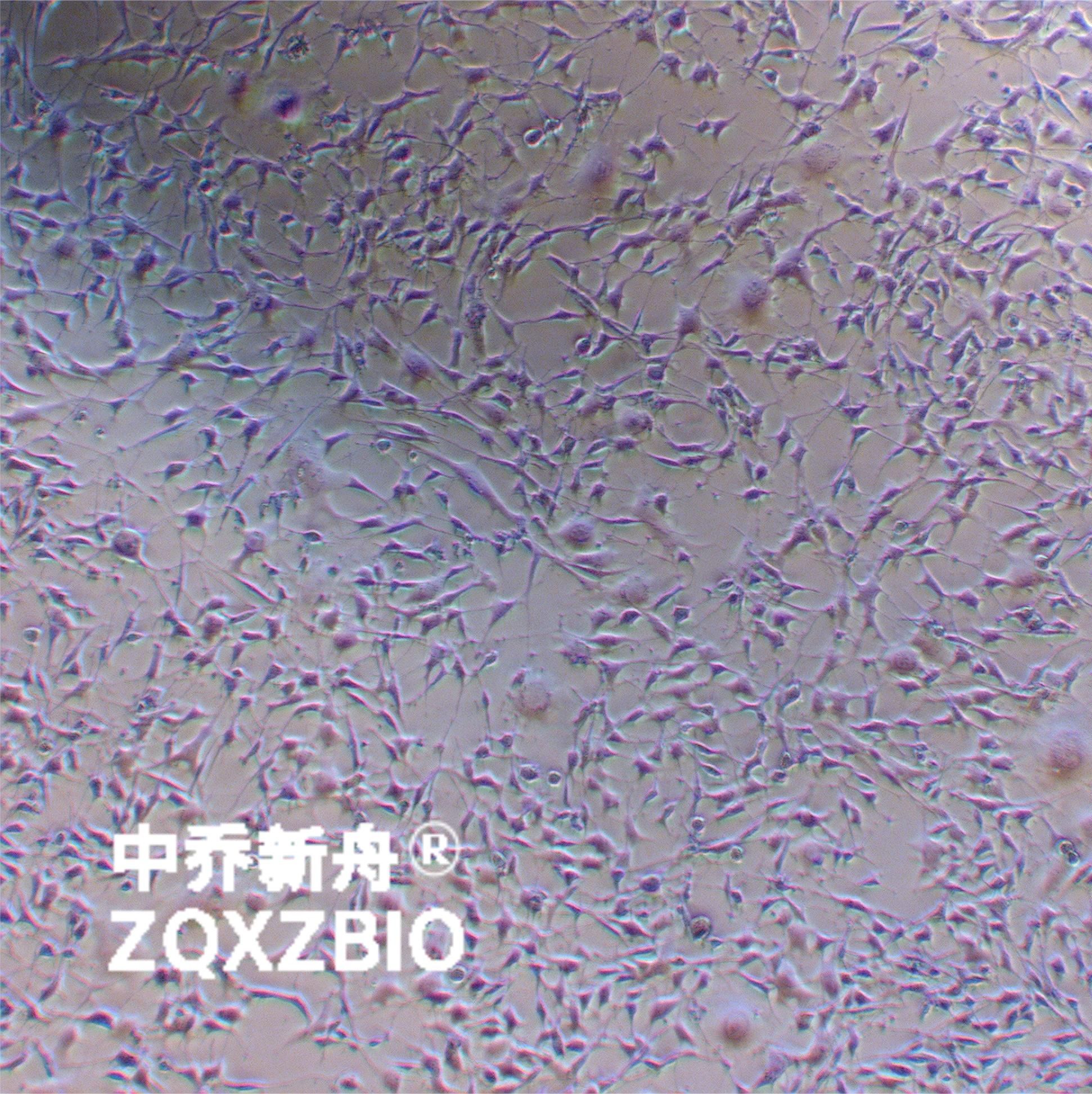 K7M2 wt [K7M2-WT]小鼠骨肉瘤成骨细胞