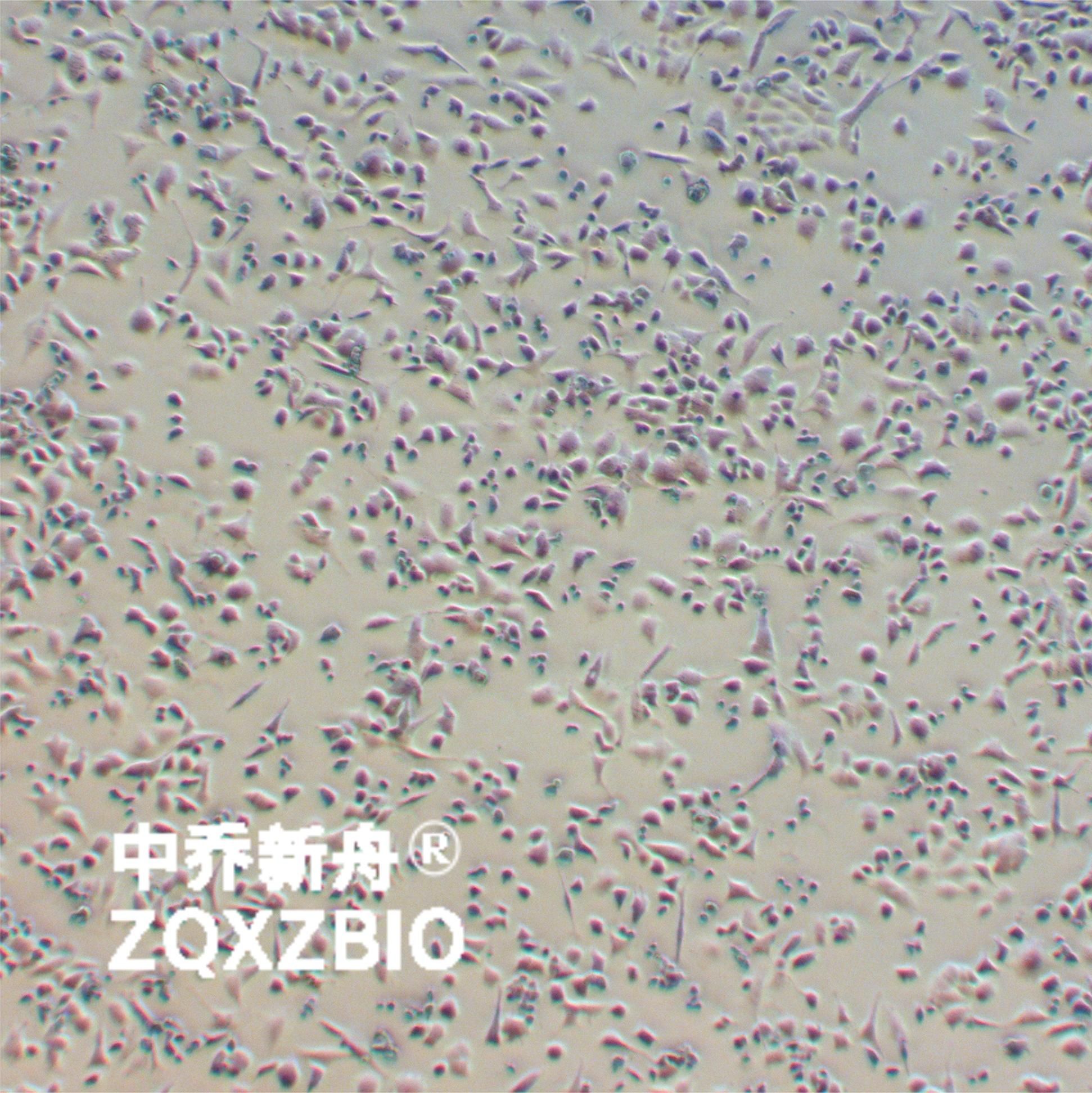 PC-12(低分化)大鼠肾上腺嗜铬细胞瘤细胞(低分化)