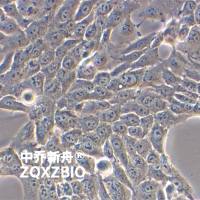 Detroit 562人咽头癌胸水转移细胞