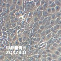 ACT-1人甲状腺癌细胞