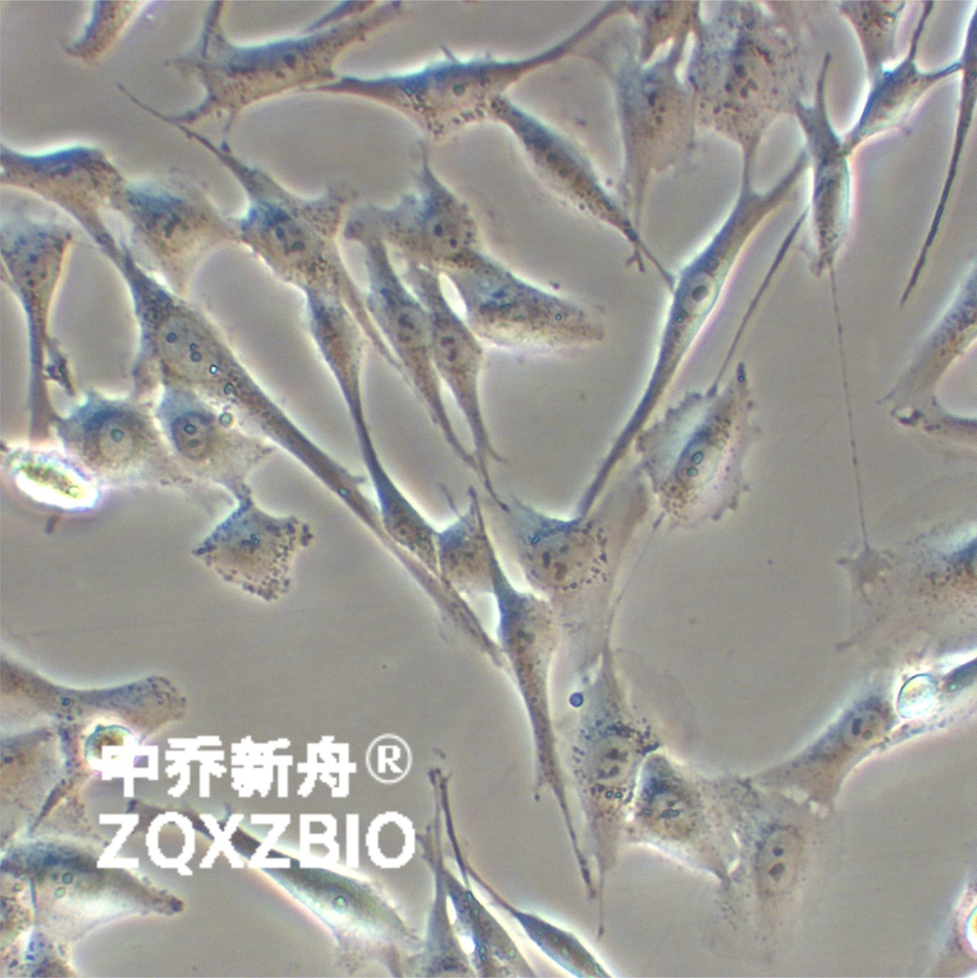 MDA-MB-435S人黑素瘤细胞