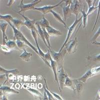 MDA-MB-435S人黑素瘤细胞