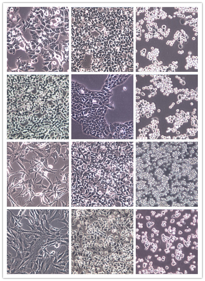 【STR鉴定】HEC-1-B、HEC-1-B细胞、HEC-1