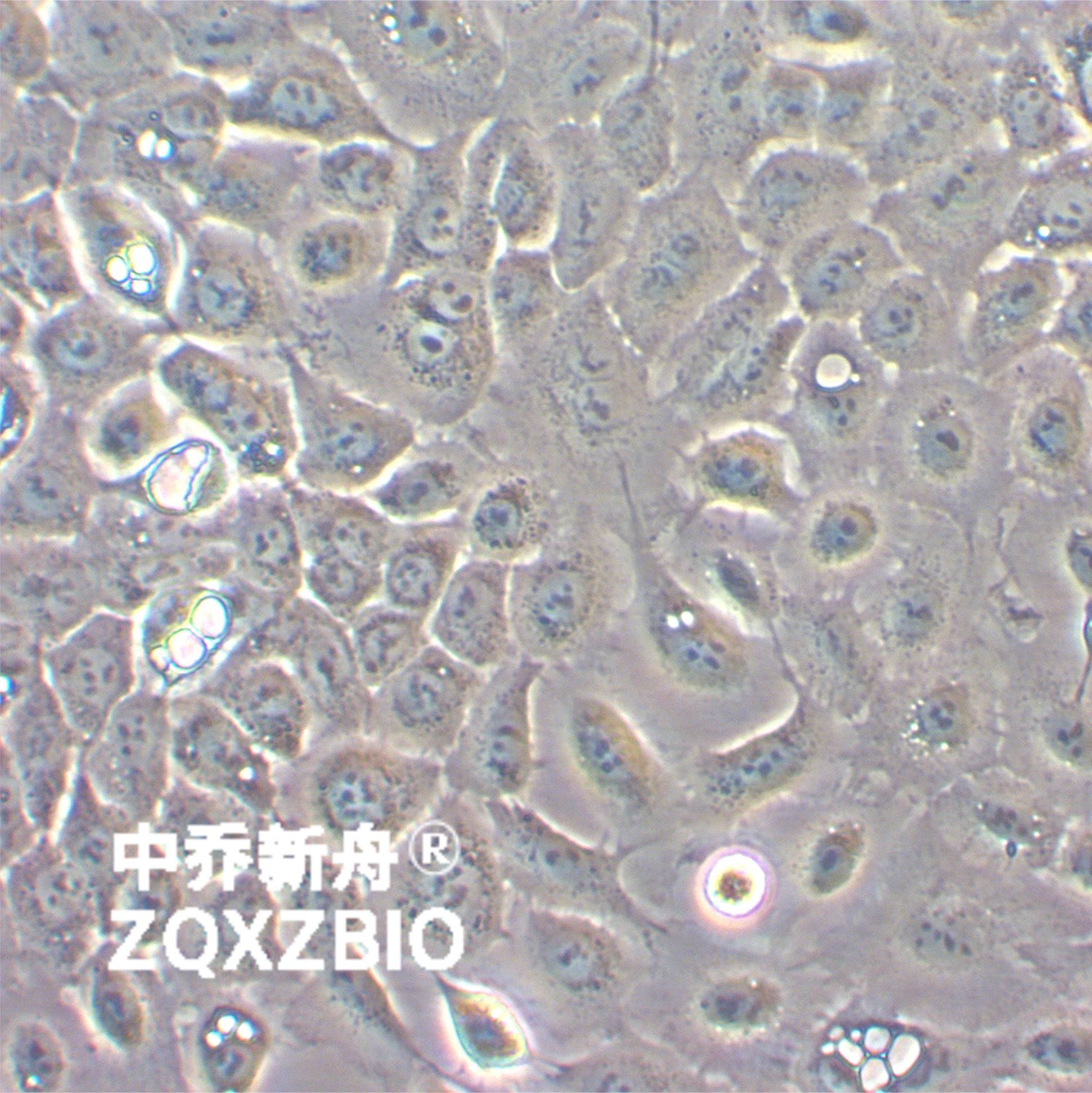 NCI-H292人肺癌细胞(淋巴结转移)