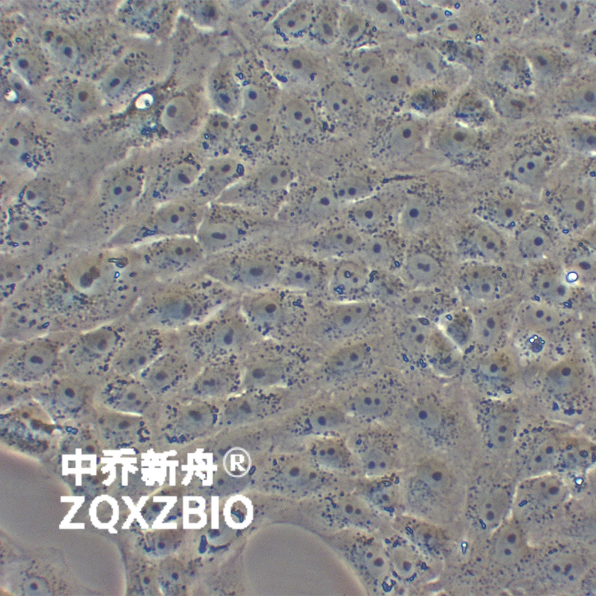 VERO C1008 (E6)非洲绿猴肾细胞