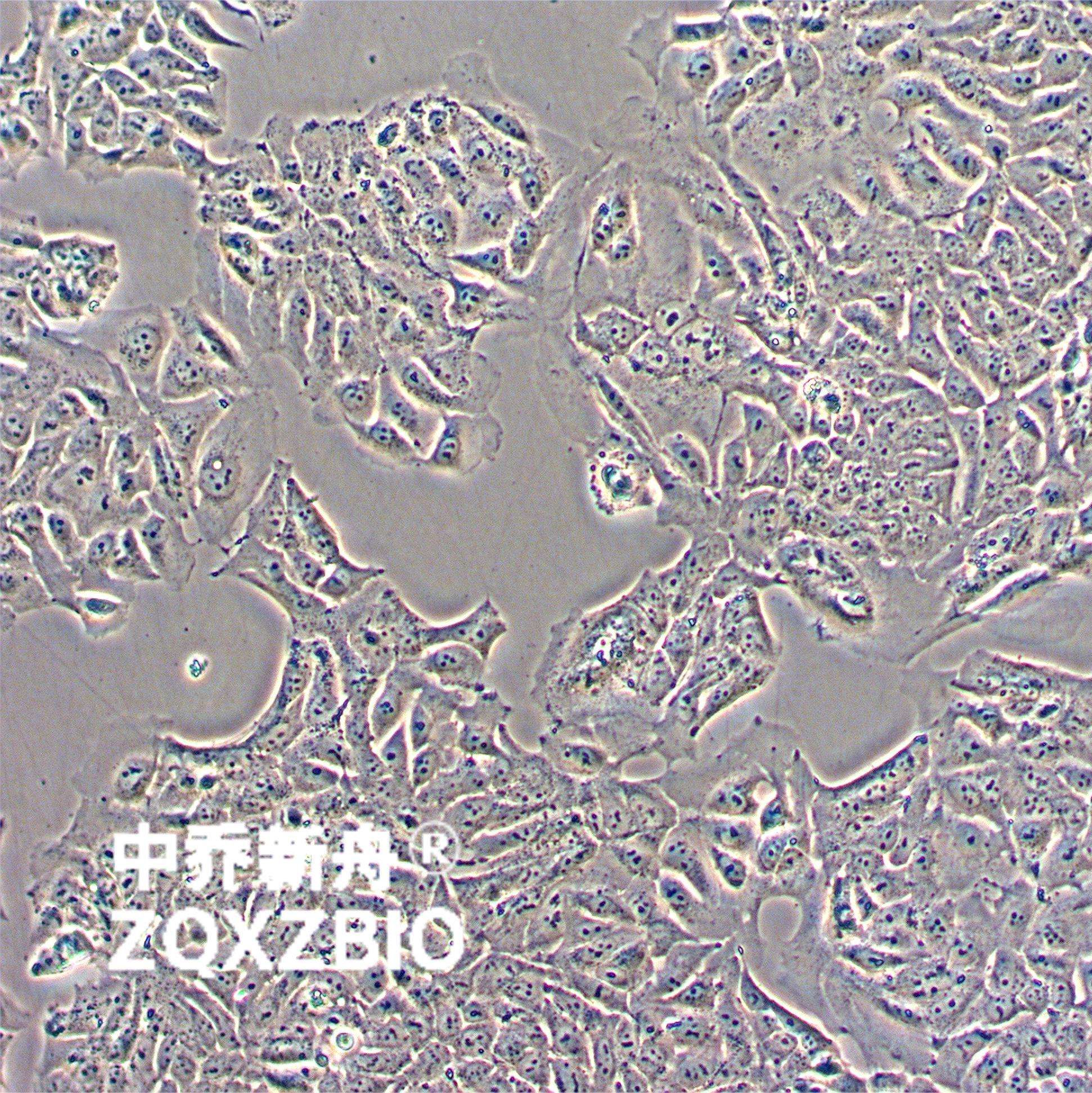 DLD-1人结直肠腺癌上皮细胞