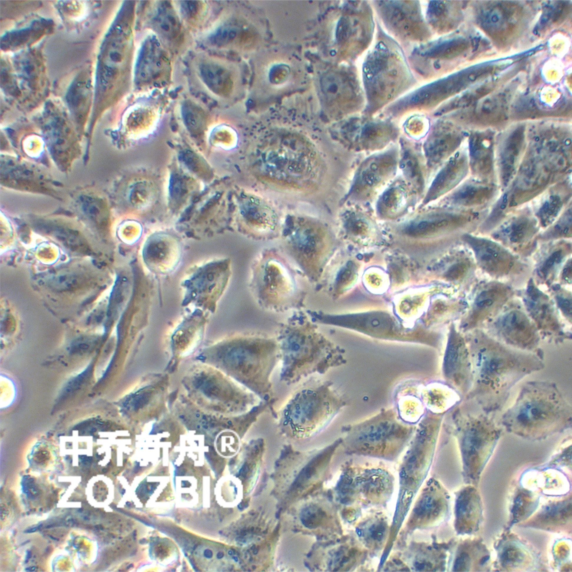 Calu-6人退行性癌细胞
