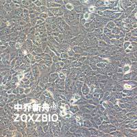 TTA1人甲状腺癌细胞