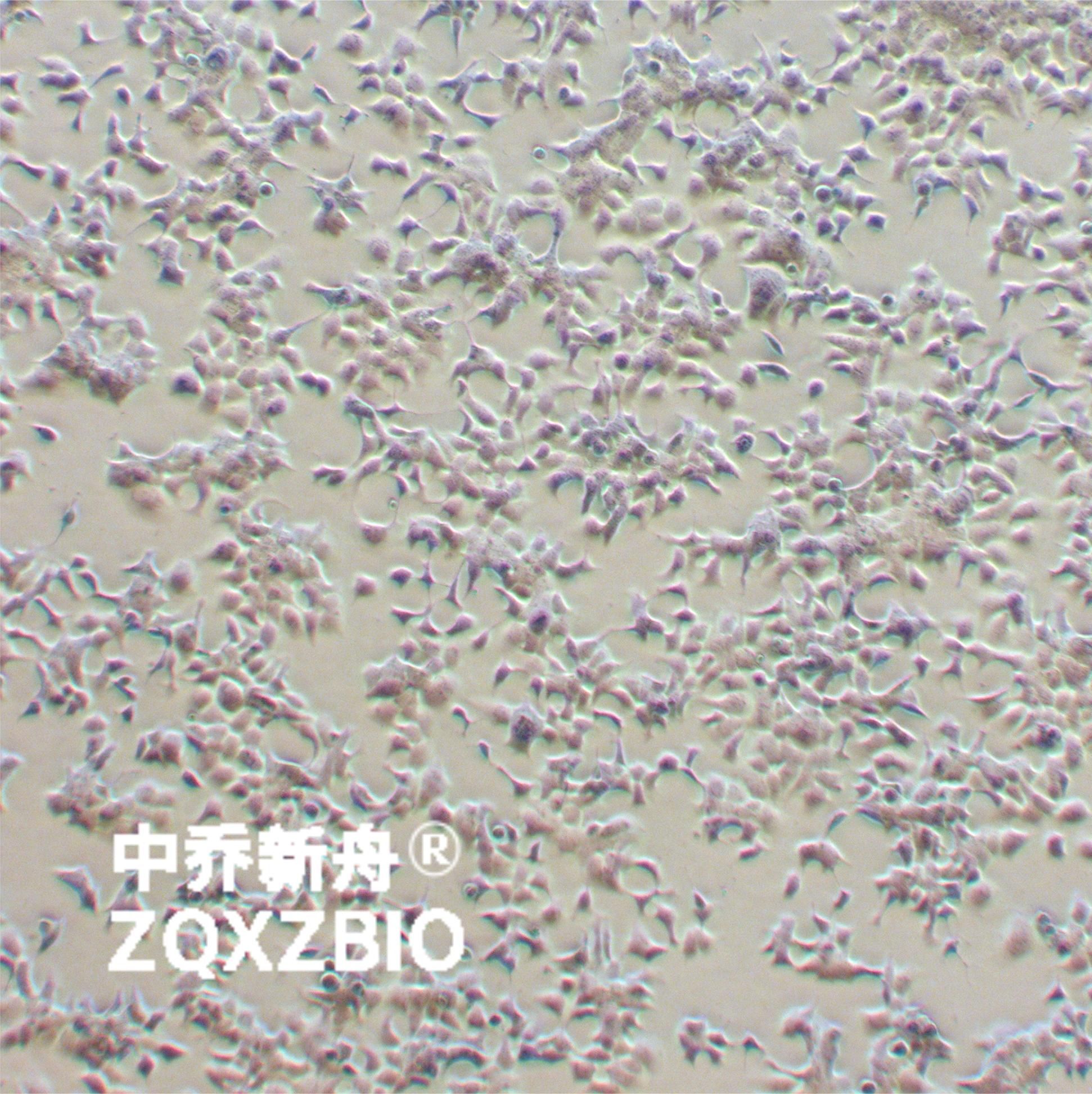 BT-474 [BT474]人乳腺导管癌细胞