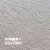 KHM-5M人甲状腺癌细胞