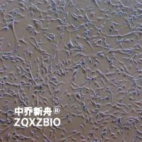 8305C人甲状腺癌细胞