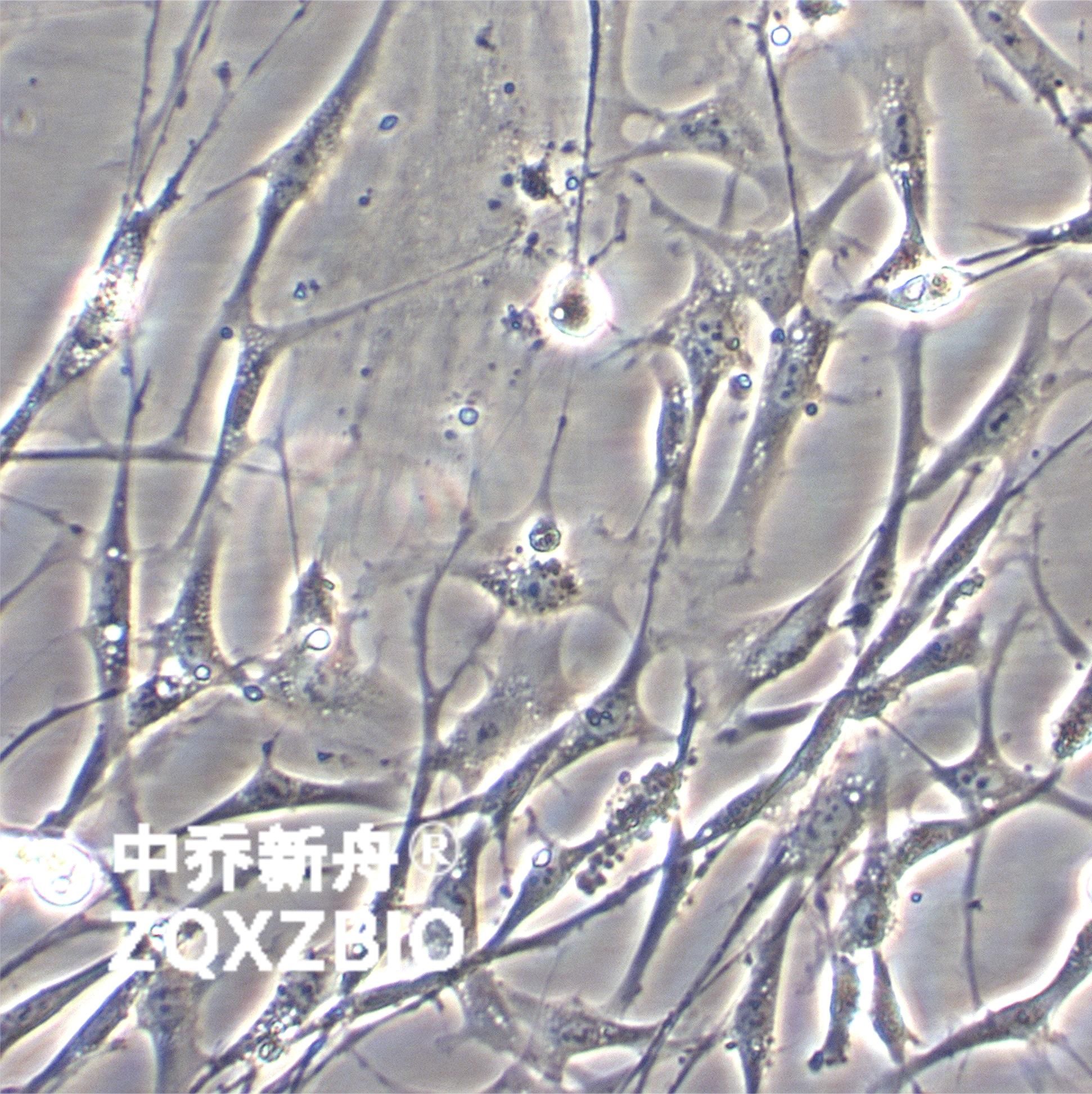 RMSC-bm Wistar大鼠骨髓MSC细胞Wistar大鼠骨髓间充质干细胞