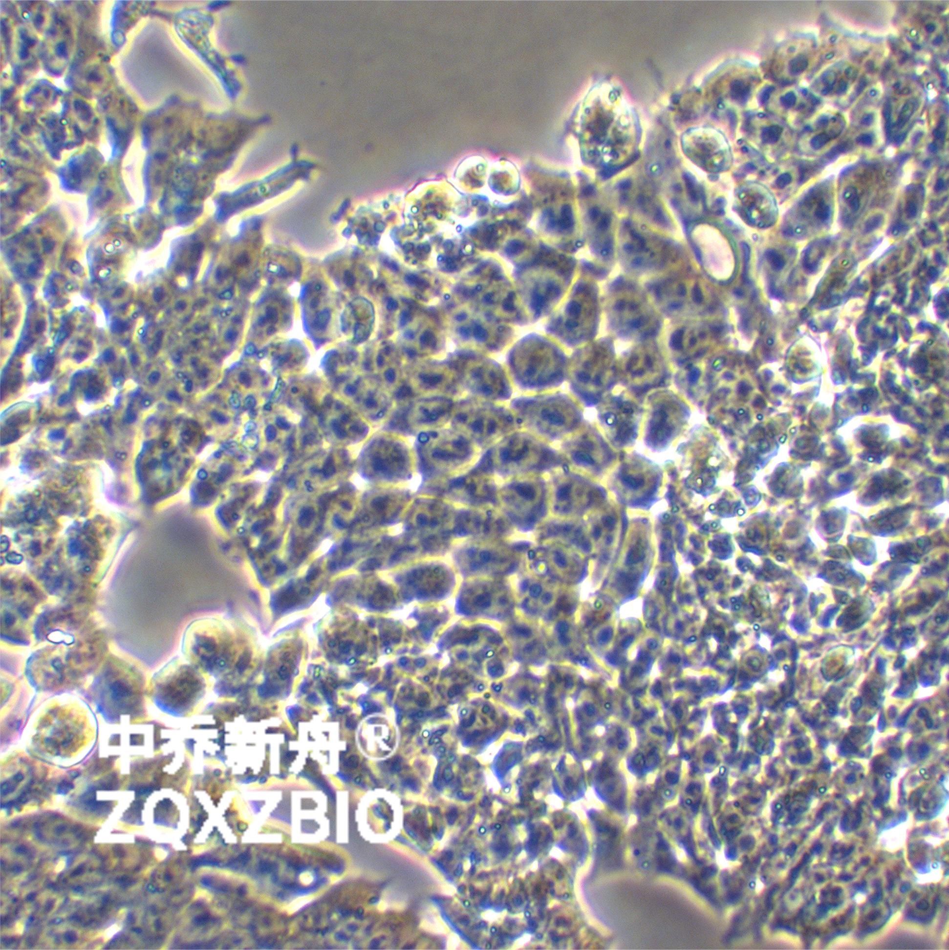 P19小鼠畸胎瘤细胞
