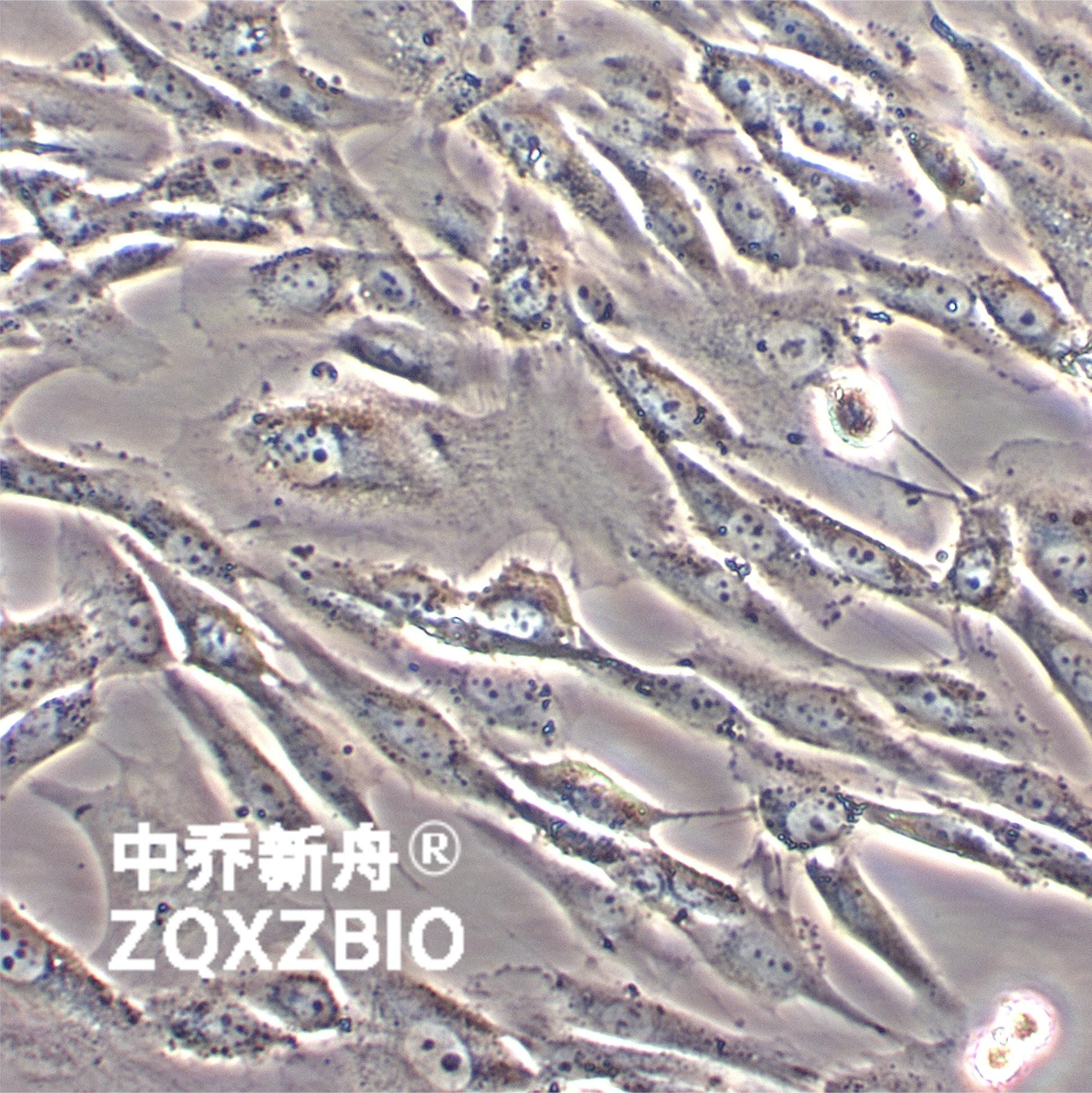 SW 982 [SW-982, SW982]人滑膜肉瘤细胞