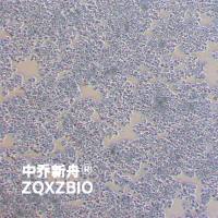 CW-2人结肠腺癌细胞