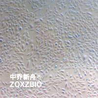 J82人膀胱移行细胞癌