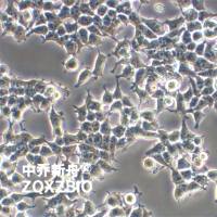 293T/17人胚肾细胞