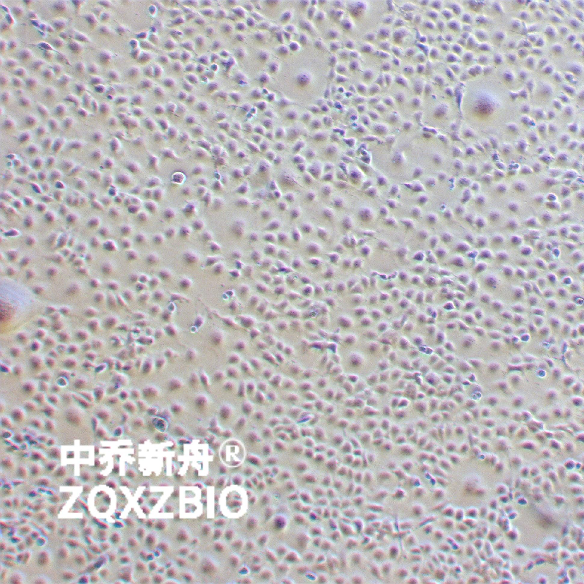 COS-7非洲绿猴SV40转化的肾细胞