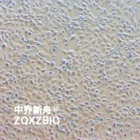 Hs 578T人乳腺癌细胞