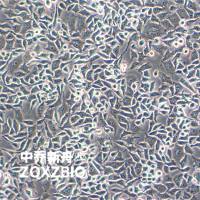 RKO-E6人结肠癌转基因细胞