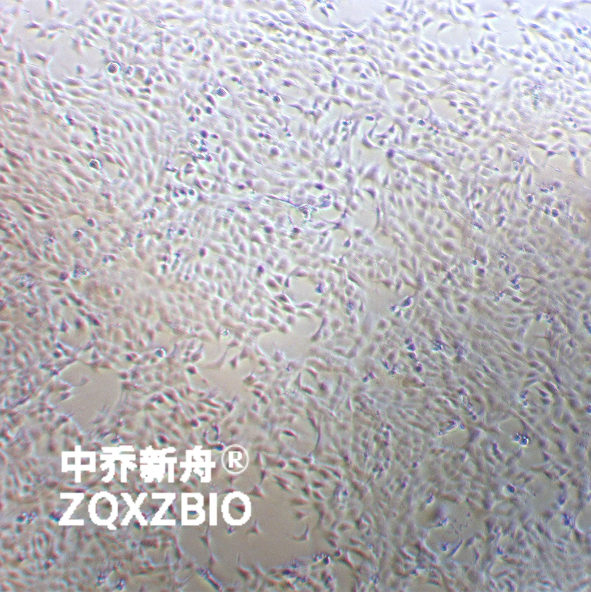 4T1小鼠乳腺癌细胞