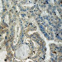 BRaf Polyclonal Antibody