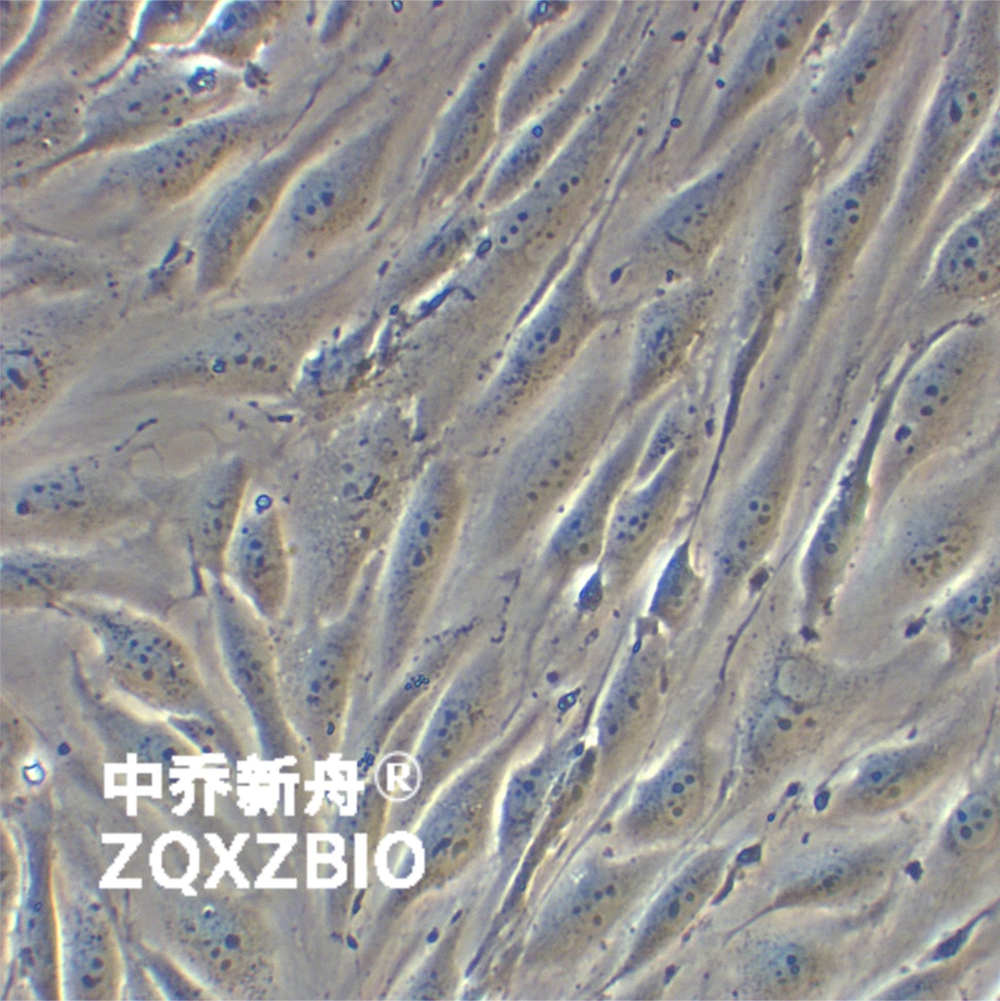 MS1小鼠胰岛内皮细胞
