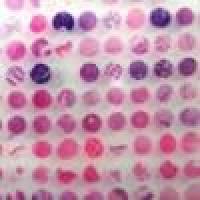 扁桃体组织芯片TON2281