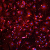 小鼠主动脉内皮细胞系、永生化小鼠主动脉内皮细胞、小鼠血管内皮细胞系