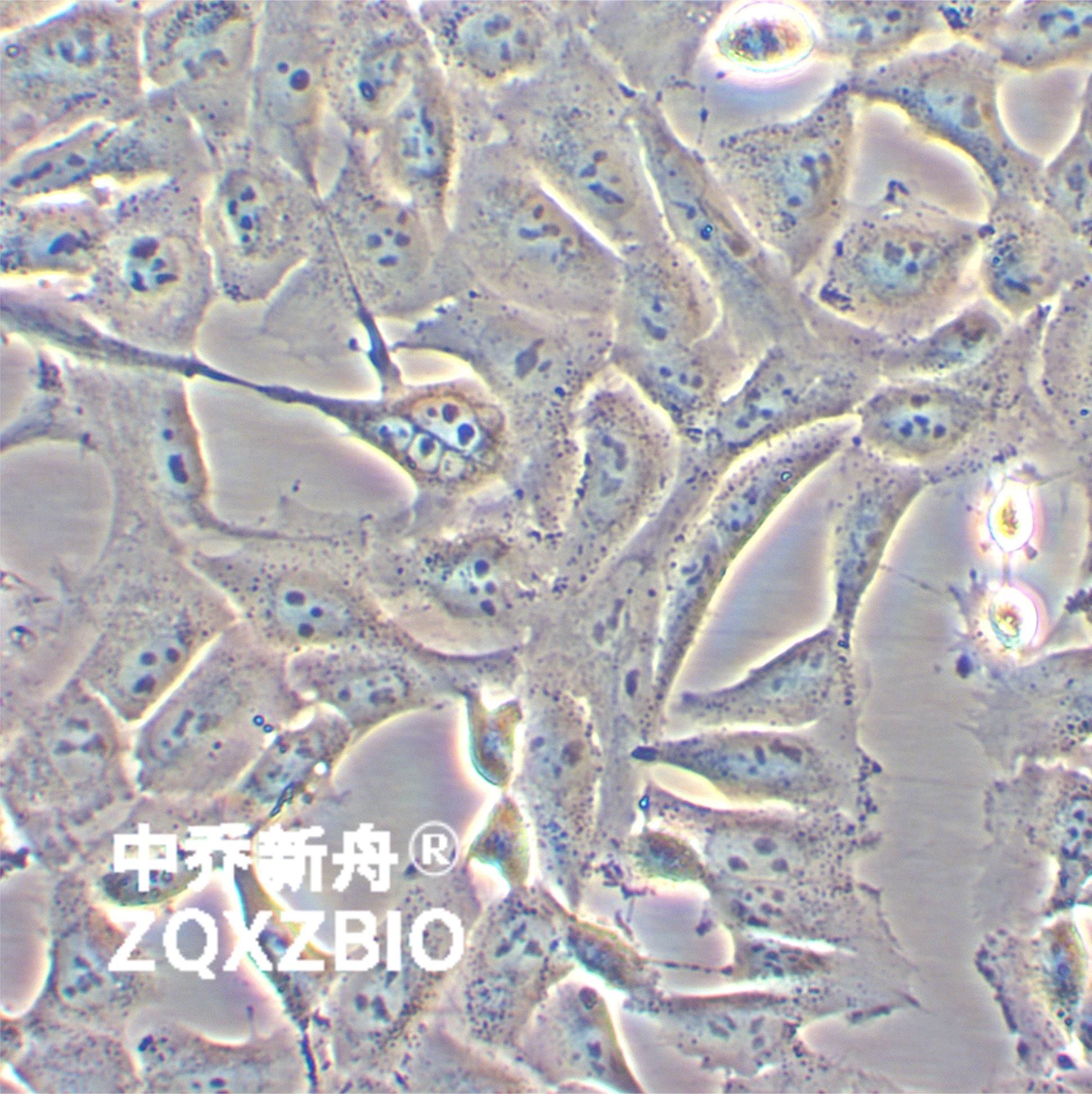 KHOS-240S人骨肉瘤细胞