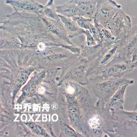 TCCSUP人膀胱癌细胞